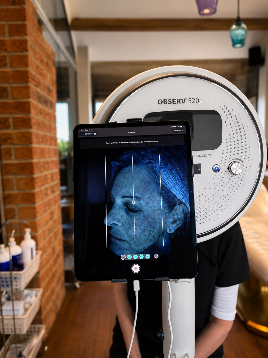 OBSERV 520x Skin Analysis York, Harrogate & Yorkshire | Advanced Skin ...